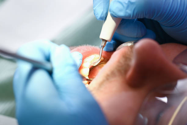 Best Emergency Broken Tooth Repair in Sullivan Gardens, TN